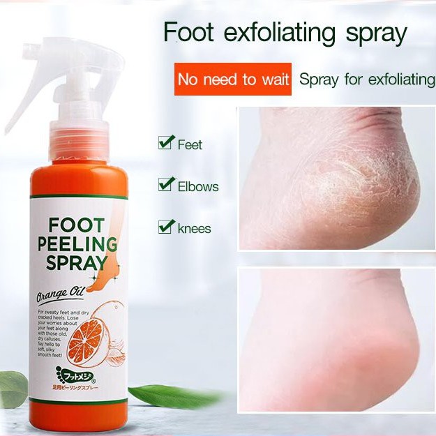 مقشر للعناية بالقدم لأقدام ناعمة وصحية (Foot Peeling Spray)