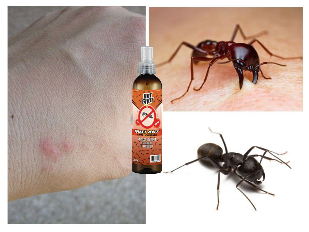 رشاش الطبيعي والآمن لطرد النمل من المنزل بدون كيماويات وبدون قتلهم –  لا يباع في المتاجر  (Anti-fourmis Spray)